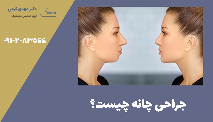 جراحی چانه چیست؟