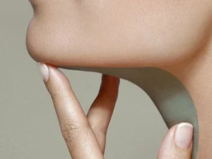 عوارض پروتز چانه