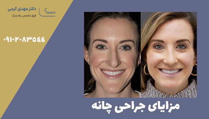مزایای جراحی چانه