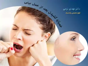 خمیازه بعد از عمل بینی