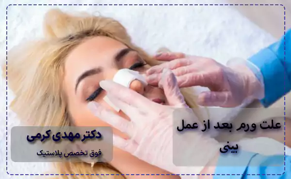 علت ورم بعد از عمل بینی