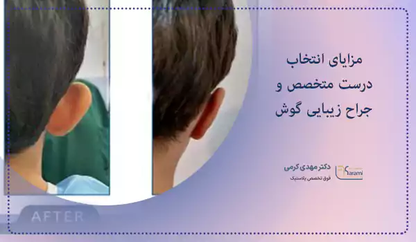 مزایای انتخاب درست متخصص و جراح زیبایی گوش