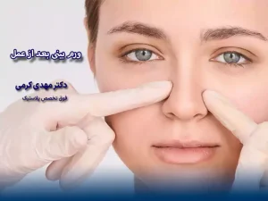 ورم بینی بعد از عمل