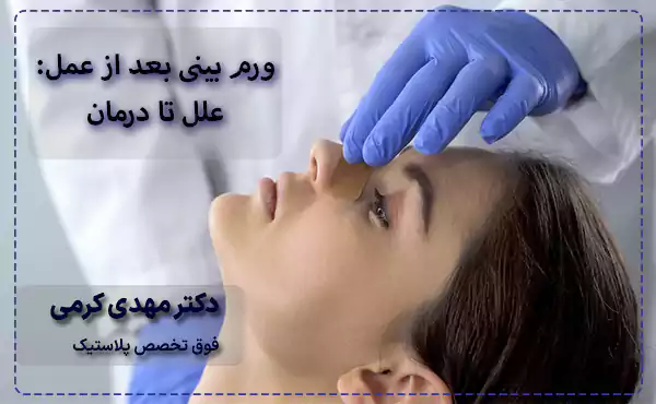 ورم بینی بعد از عمل علل تا درمان