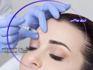 تزریق بوتاکس