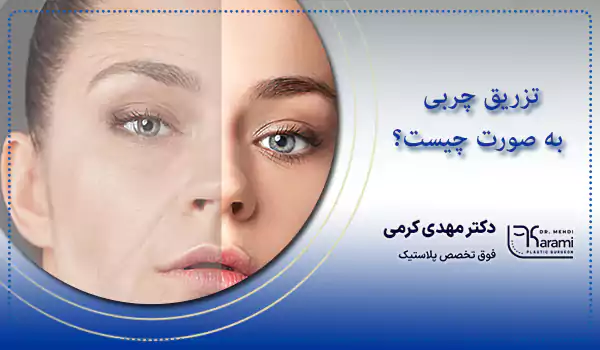 تزریق چربی به صورت چیست؟