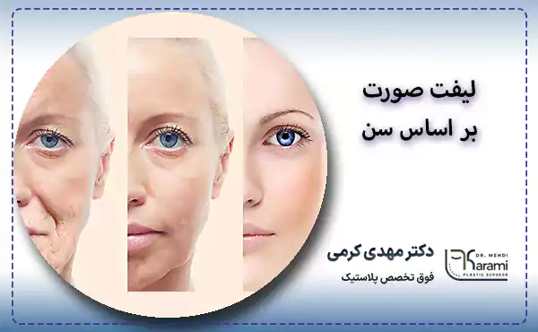 لیفت صورت بر اساس سن