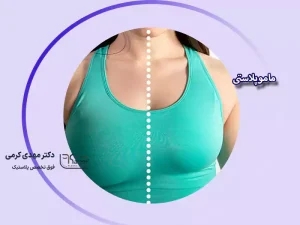 ماموپلاستی