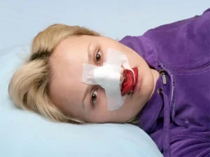 جراحی بینی بدون تامپون چه مزیتی دارد