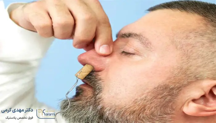 عمل بینی بدون تامپون چگونه است