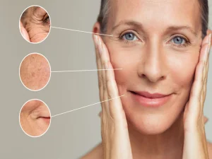 بهترین سن برای انجام لیفت صورت چه سنی است؟