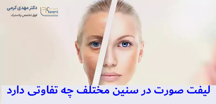 لیفت صورت در سنین مختلف چه تفاوتی دارد