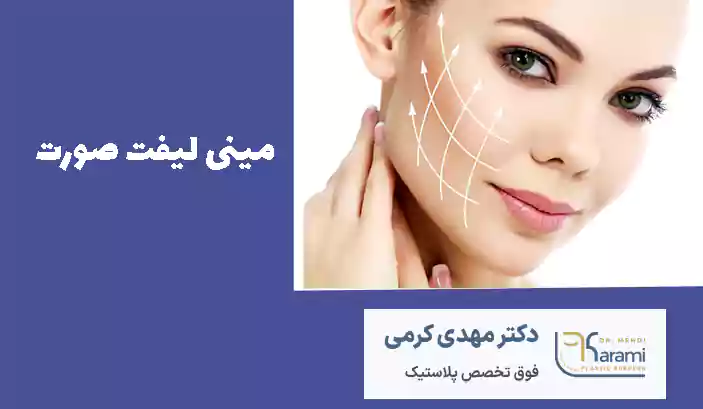 مینی لیفت صورت