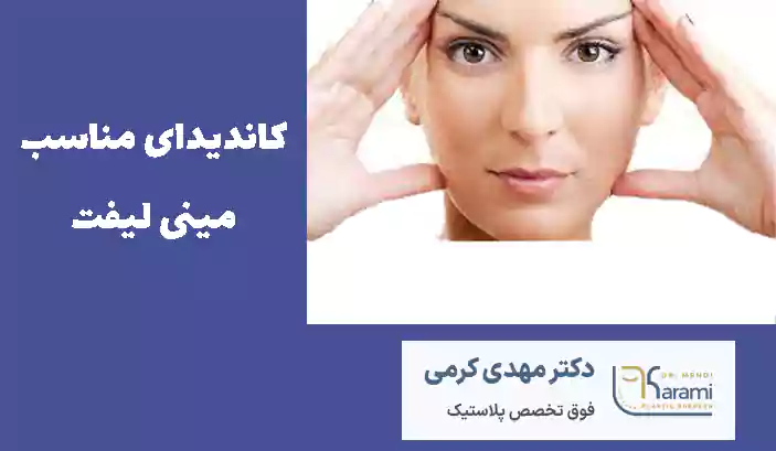 کاندیدای مناسب مینی لیفت