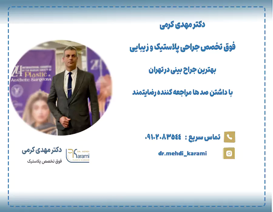 بهترین جراح بینی دکتر مهدی کرمی