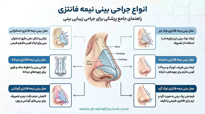 انواع عمل بینی نیمه فانتزی - حرفه_ای