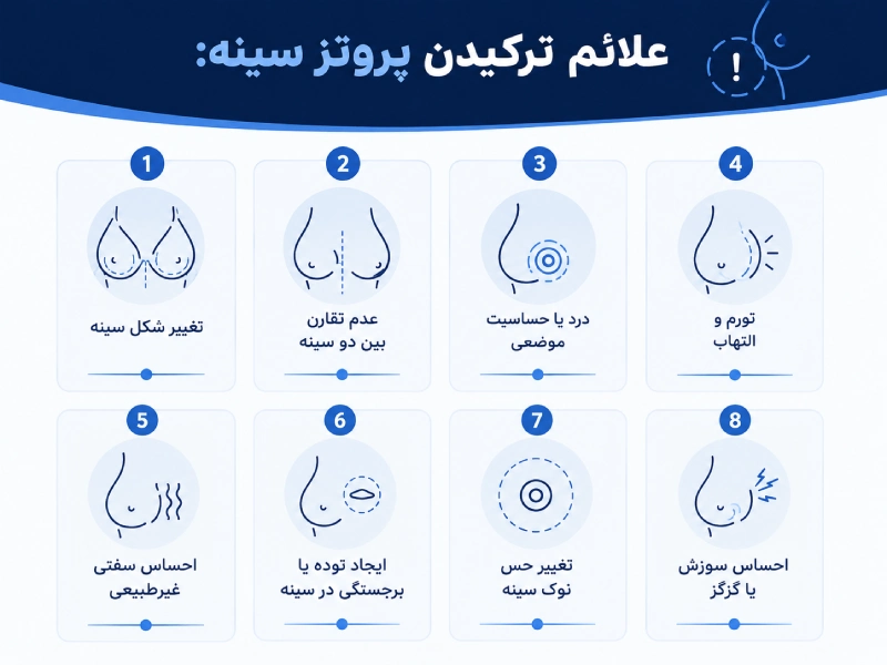 علائم ترکیدن پروتز سینه